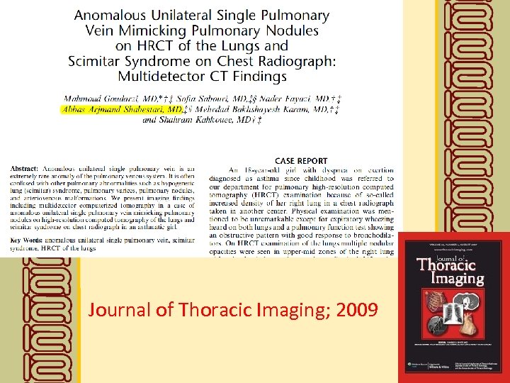 Journal of Thoracic Imaging; 2009 