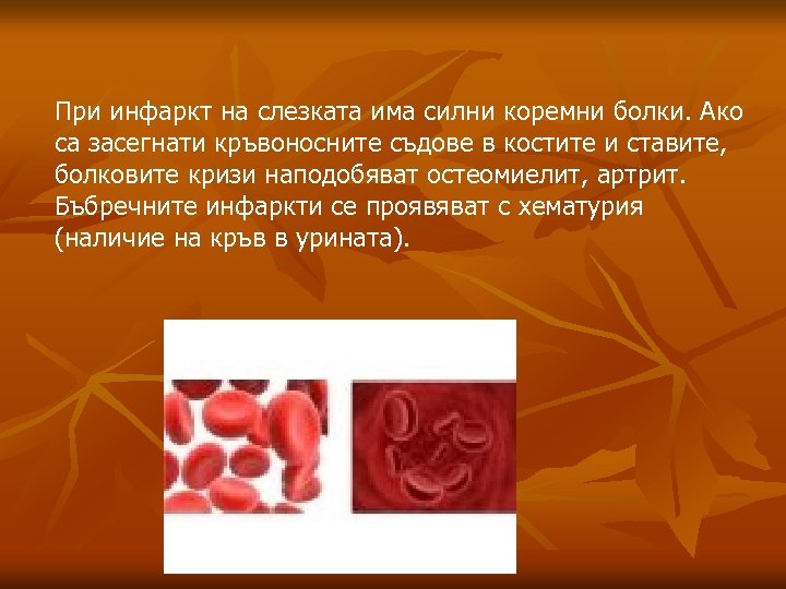 При инфаркт на слезката има силни коремни болки. Ако са засегнати кръвоносните съдове в