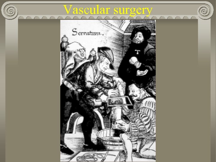 Vascular surgery 