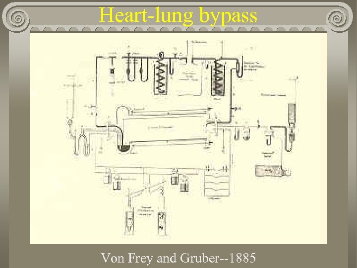 Heart-lung bypass Von Frey and Gruber--1885 