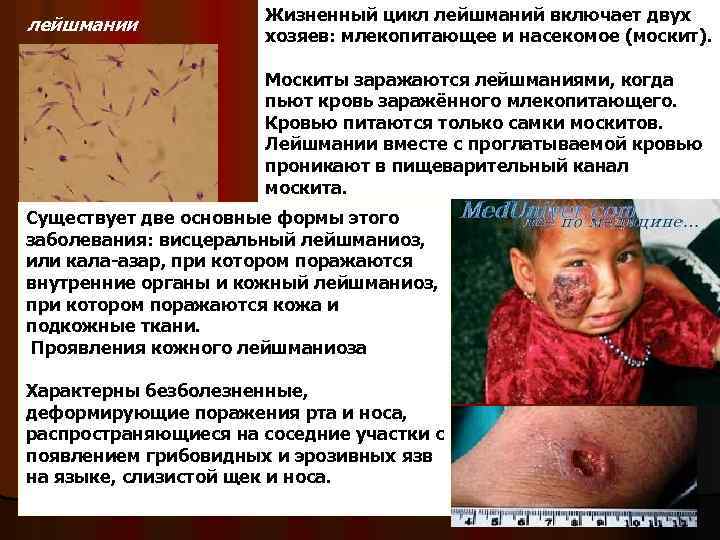 лейшмании Жизненный цикл лейшманий включает двух хозяев: млекопитающее и насекомое (москит). Москиты заражаются лейшманиями,