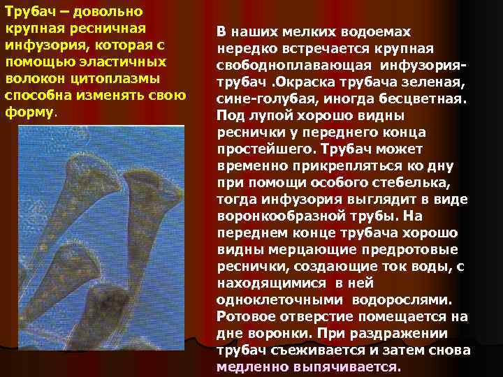Трубач – довольно крупная ресничная инфузория, которая с помощью эластичных волокон цитоплазмы способна изменять