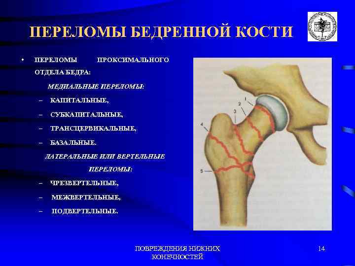 Презентация переломы нижней конечности