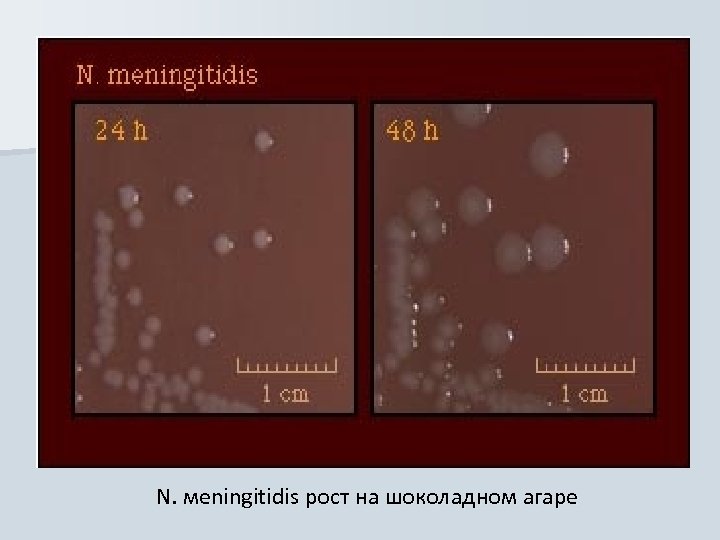 N. мeningitidis рост на шоколадном агаре 