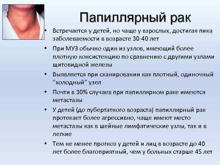 Папиллярный рак • Встречается у детей, но чаще у взрослых, достигая пика заболеваемости в