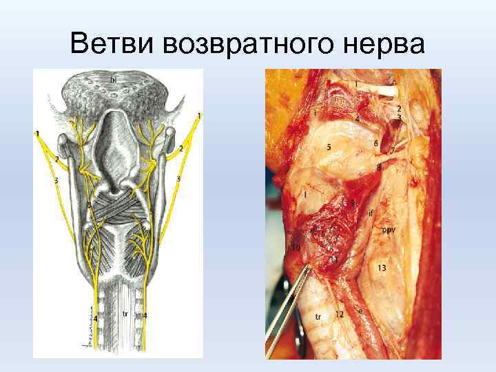 Ветви возвратного нерва 