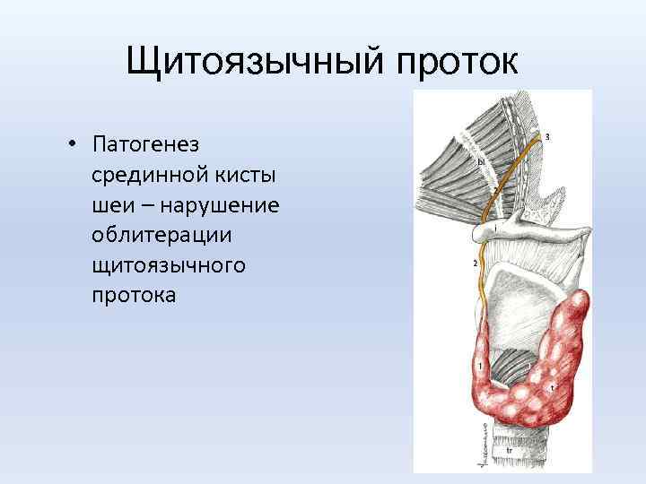 Щитоязычный проток • Патогенез срединной кисты шеи – нарушение облитерации щитоязычного протока 