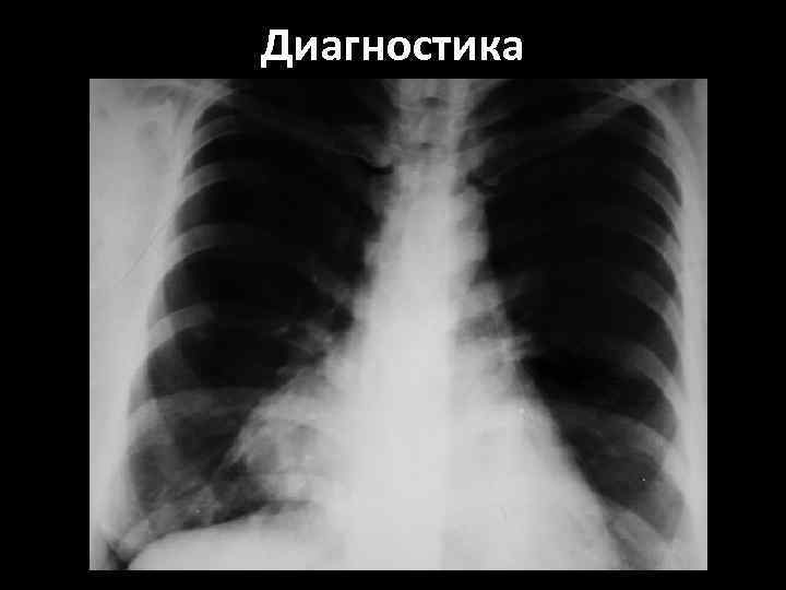 Диагностика 