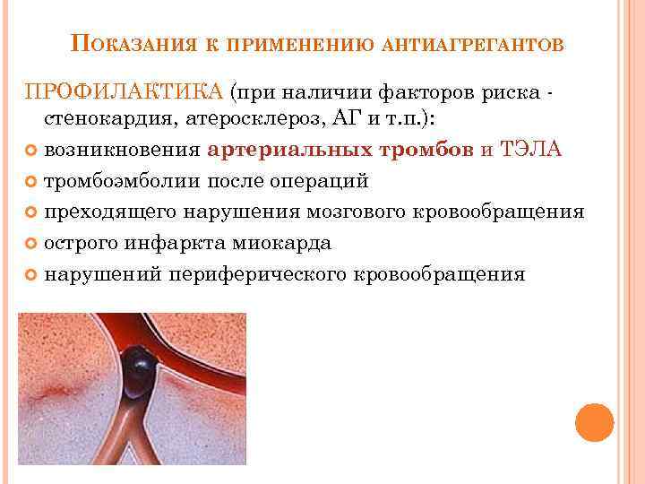 ПОКАЗАНИЯ К ПРИМЕНЕНИЮ АНТИАГРЕГАНТОВ ПРОФИЛАКТИКА (при наличии факторов риска стенокардия, атеросклероз, АГ и т.