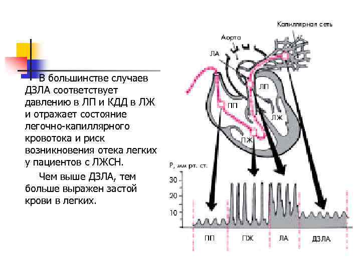 Легочное давление. Давление заклинивания легочной артерии. Измерение давления в легочной артерии. Давление заклинивания легочной артерии норма. Заклинивание легочной артерии что такое.