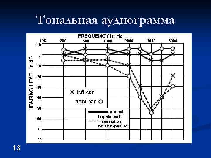 Тональная аудиограмма 13 