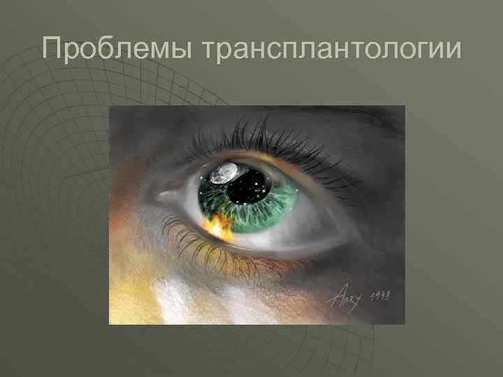 Проблемы трансплантологии 