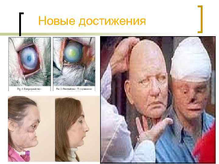 Новые достижения 