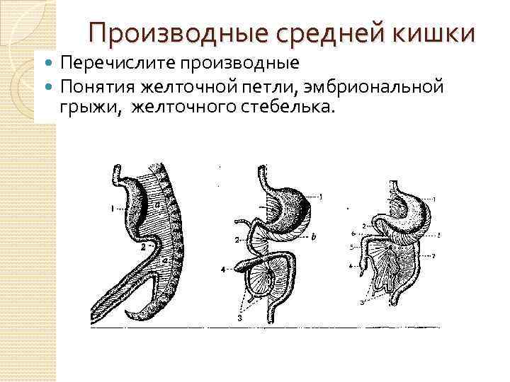 Эмбриональные грыжи презентация