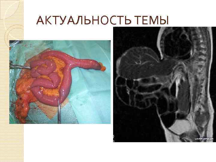 АКТУАЛЬНОСТЬ ТЕМЫ 