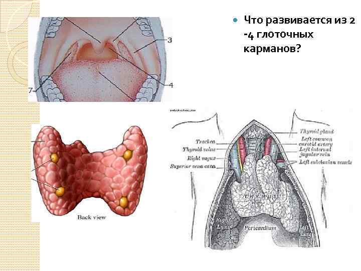  Что развивается из 2 -4 глоточных карманов? 