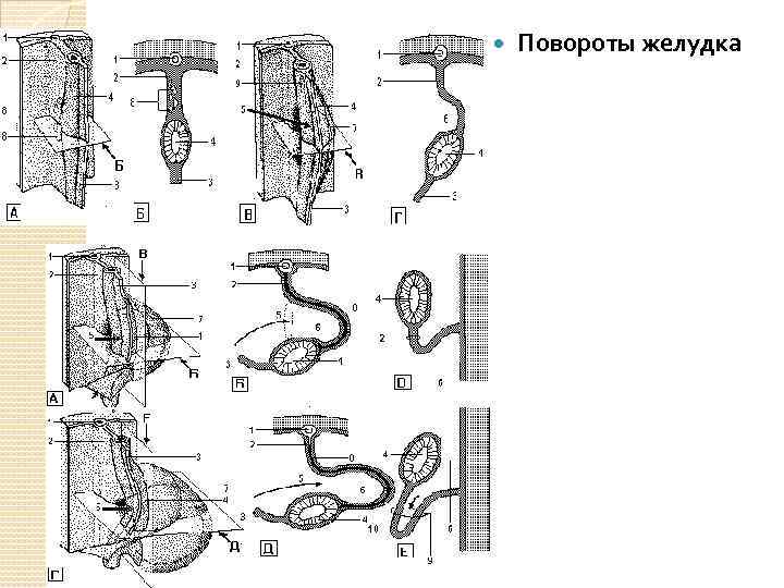  Повороты желудка 