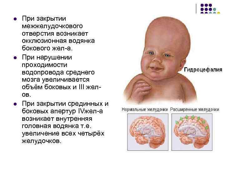 l l l При закрытии межжелудочкового отверстия возникает окклюзионная водянка бокового жел-а. При нарушении