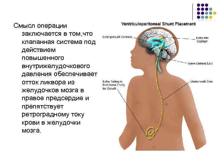 Смысл операции