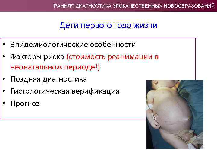 РАННЯЯ ДИАГНОСТИКА ЗЛОКАЧЕСТВЕННЫХ НОВООБРАЗОВАНИЙ Дети первого года жизни • Эпидемиологические особенности • Факторы риска