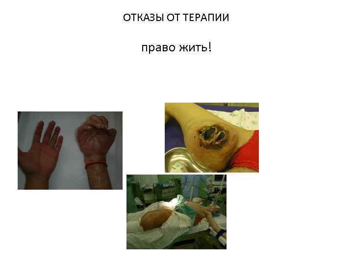ОТКАЗЫ ОТ ТЕРАПИИ право жить! 