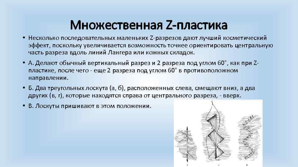 Множественная Z-пластика • Несколько последовательных маленьких Z разрезов дают лучший косметический эффект, поскольку увеличивается