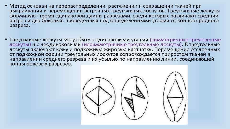 Среднее направление. Пластика встречными треугольными лоскутами по Лимбергу. Пластика по Лимбергу встречными лоскутами. Методика пластики встречными треугольными лоскутами:. Треугольные лоскуты по Лимбергу.