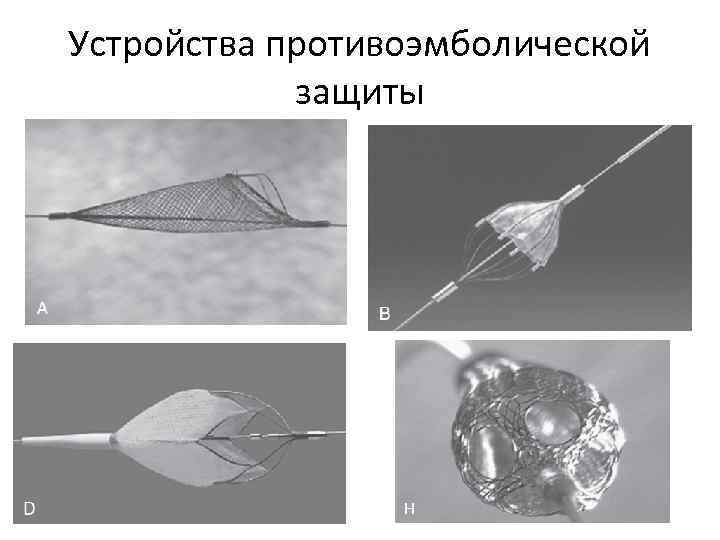 Устройства противоэмболической защиты 