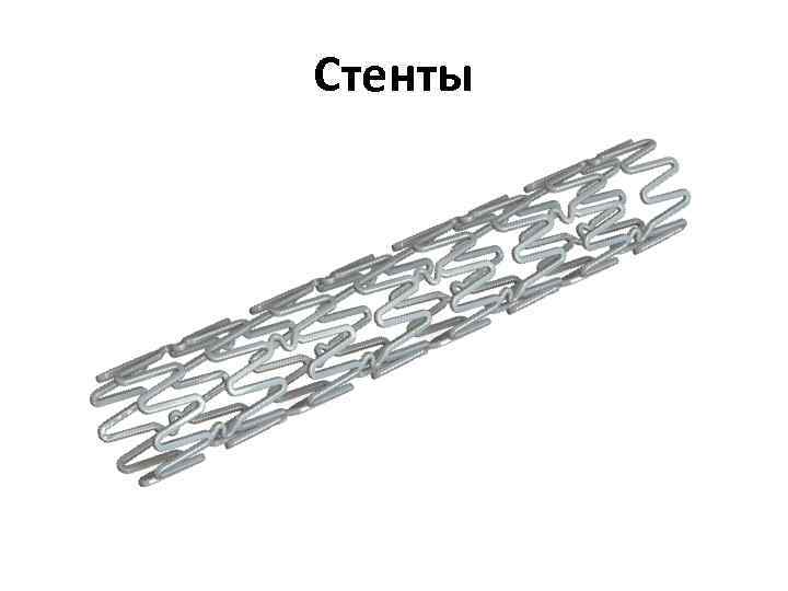 Стенты 
