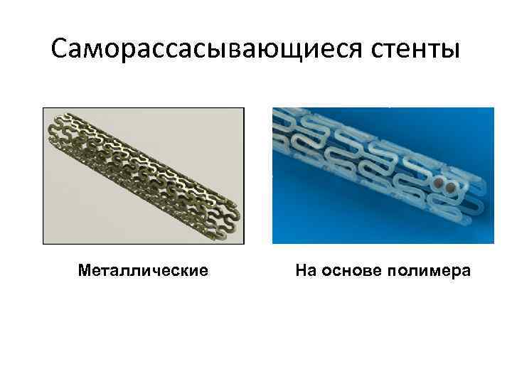 Саморассасывающиеся стенты Металлические На основе полимера 