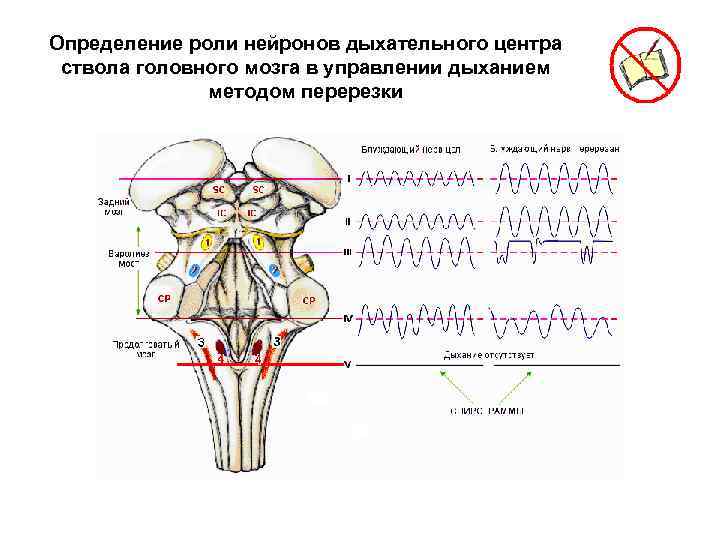 Определение роли нейронов дыхательного центра ствола головного мозга в управлении дыханием методом перерезки 