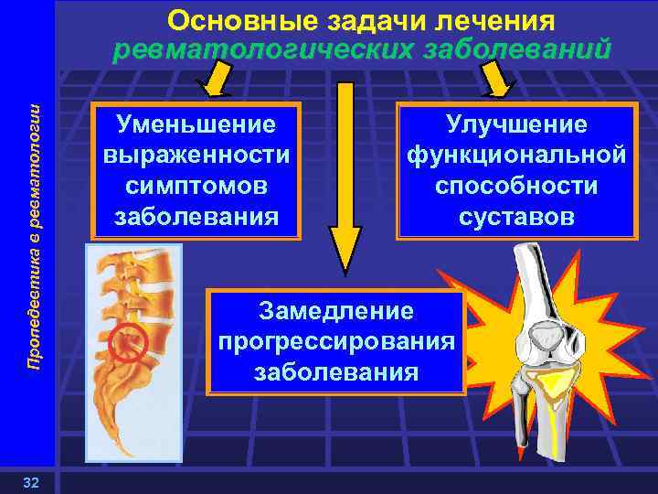 Пропедевтика в ревматологии Основные задачи лечения ревматологических заболеваний 32 Уменьшение выраженности симптомов заболевания Улучшение