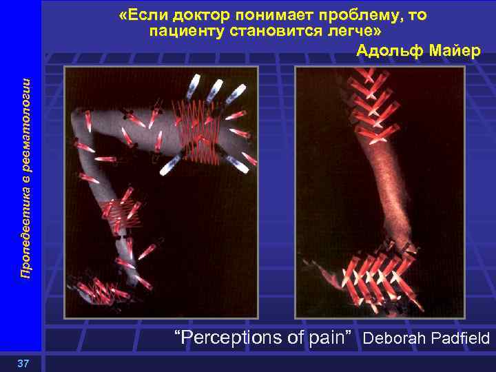 Пропедевтика в ревматологии «Если доктор понимает проблему, то пациенту становится легче» Адольф Майер “Perceptions