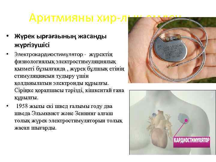 Аритмияны хир-лық емдеу • Жүрек ырғағаының жасанды жүргізушісі • Электрокардиостимулятор - жүректің физиологиялық электростимуляциялық