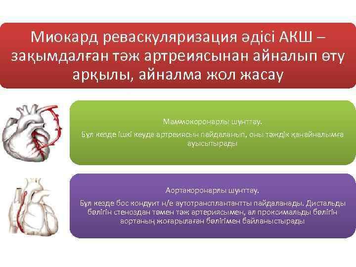 Миокард реваскуляризация әдісі АКШ – зақымдалған тәж артреиясынан айналып өту арқылы, айналма жол жасау