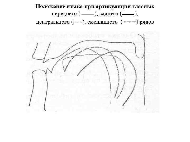 Положение языка