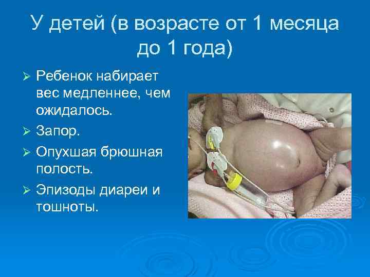 У детей (в возрасте от 1 месяца до 1 года) Ребенок набирает вес медленнее,