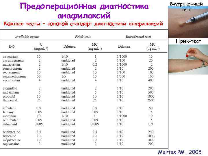 Предоперационная диагностика анафилаксий Внутрикожный тест Кожные тесты – золотой стандарт диагностики анафилаксий Прик-тест Mertes