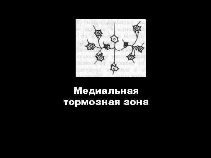 Медиальная тормозная зона 