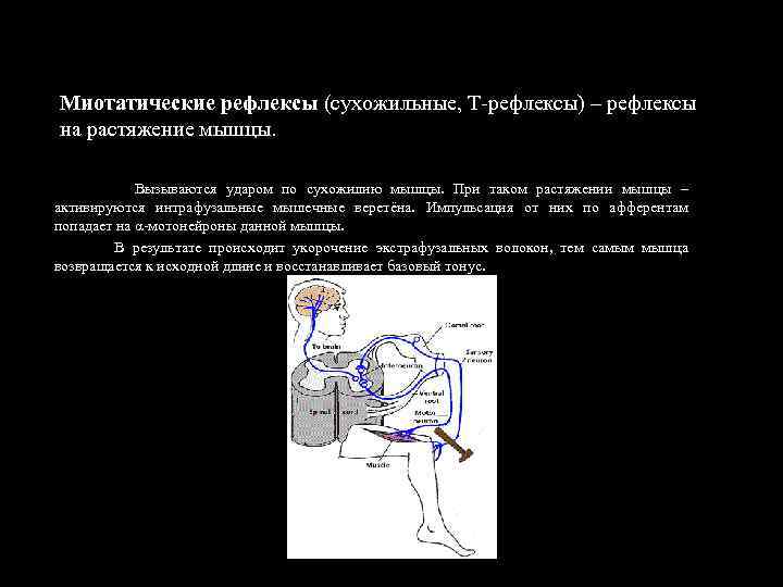 Миотатические рефлексы (сухожильные, Т-рефлексы) – рефлексы на растяжение мышцы. Вызываются ударом по сухожилию мышцы.