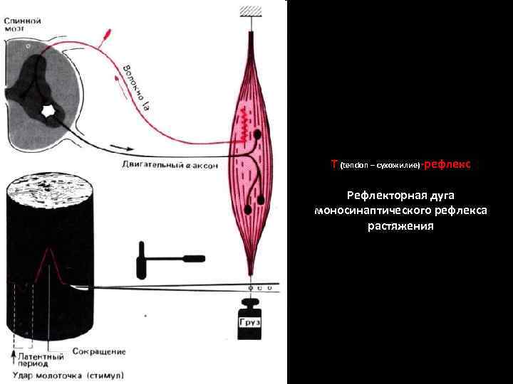 Т (tendon – сухожилие)-рефлекс Рефлекторная дуга моносинаптического рефлекса растяжения 