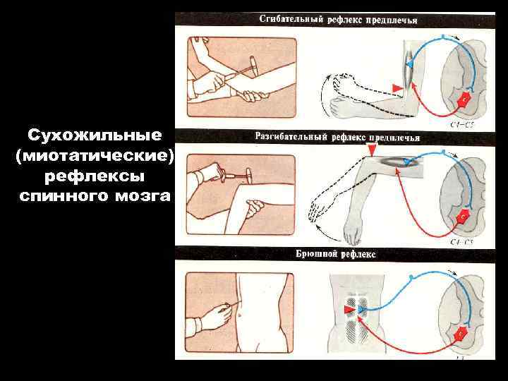 Сухожильные (миотатические) рефлексы спинного мозга 