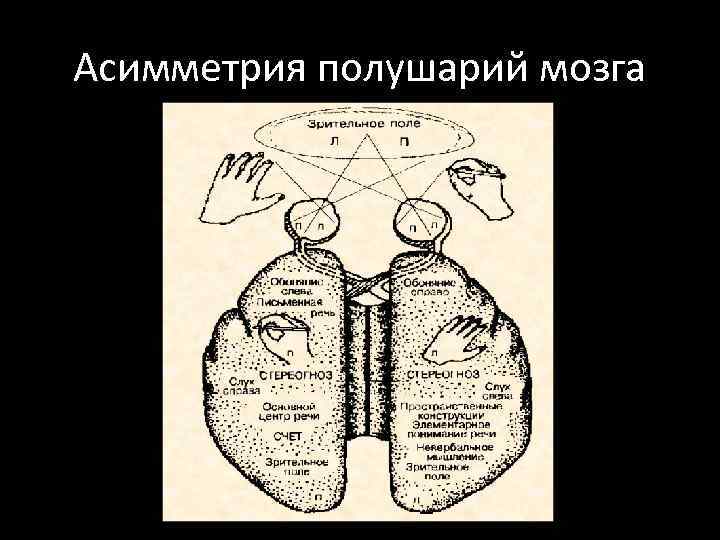 Асимметрия полушарий мозга 