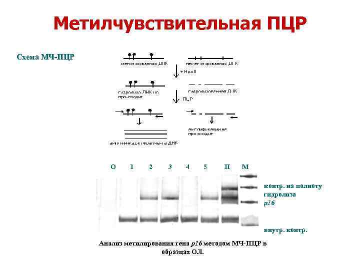 Метилчувствительная ПЦР Схема МЧ-ПЦР О 1 2 3 4 5 П М - контр.