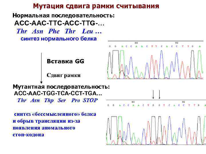 Мутация сдвига рамки считывания Нормальная последовательность: ACC-AAC-TTC-ACC-TTG-… Thr Asn Phe Thr Leu … синтез