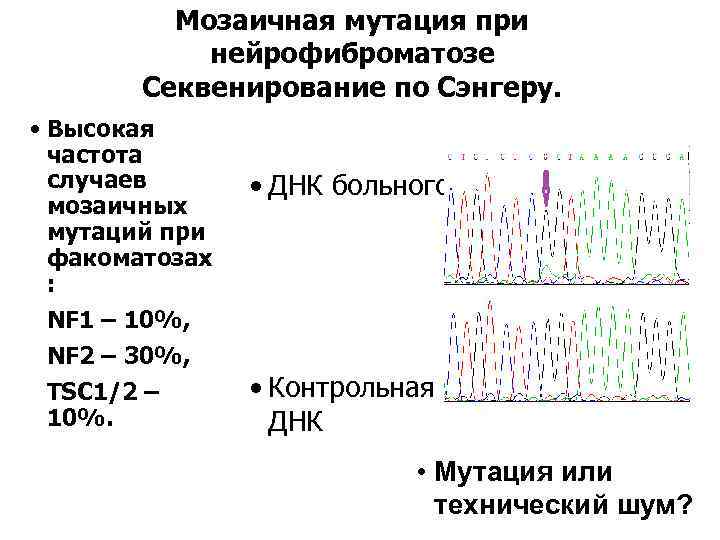 Мозаичная мутация при нейрофиброматозе Секвенирование по Сэнгеру. • Высокая частота случаев мозаичных мутаций при