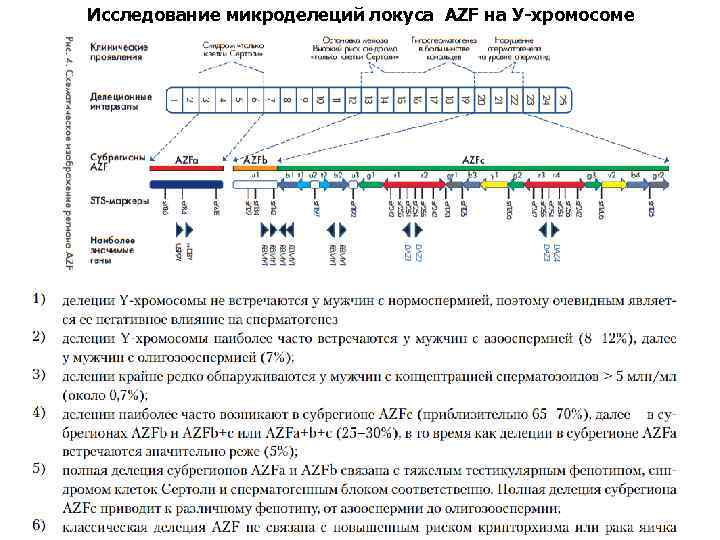 Исследование микроделеций локуса AZF на У-хромосоме 