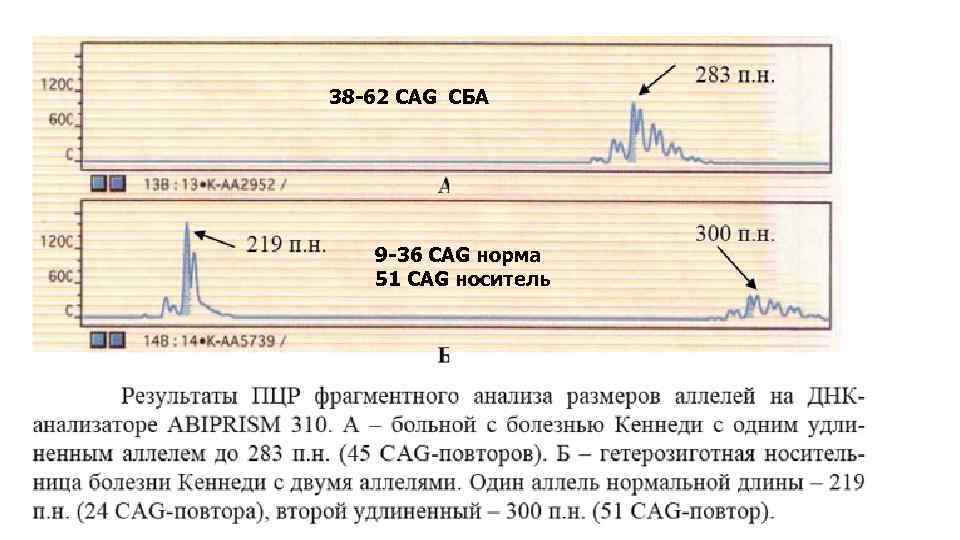 38 -62 CAG СБА 9 -36 CAG норма 51 CAG носитель 