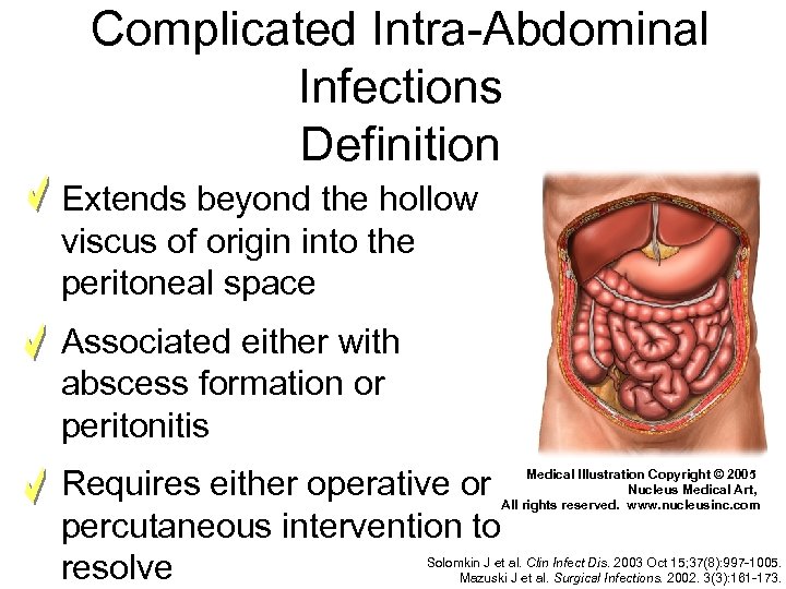 Complicated Intra-Abdominal Infections Definition Extends beyond the hollow viscus of origin into the peritoneal