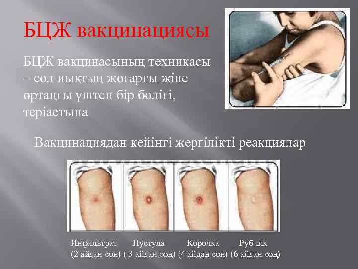 БЦЖ вакцинациясы БЦЖ вакцинасының техникасы – сол иықтың жоғарғы жіне ортаңғы үштен бір бөлігі,
